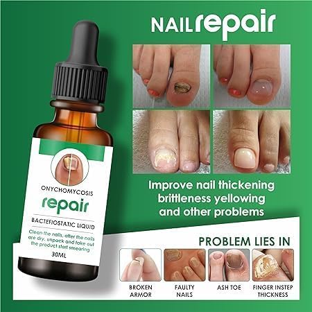 Fast Nail Care Essence | Nail Care Serum for Damaged & Discolored Nails