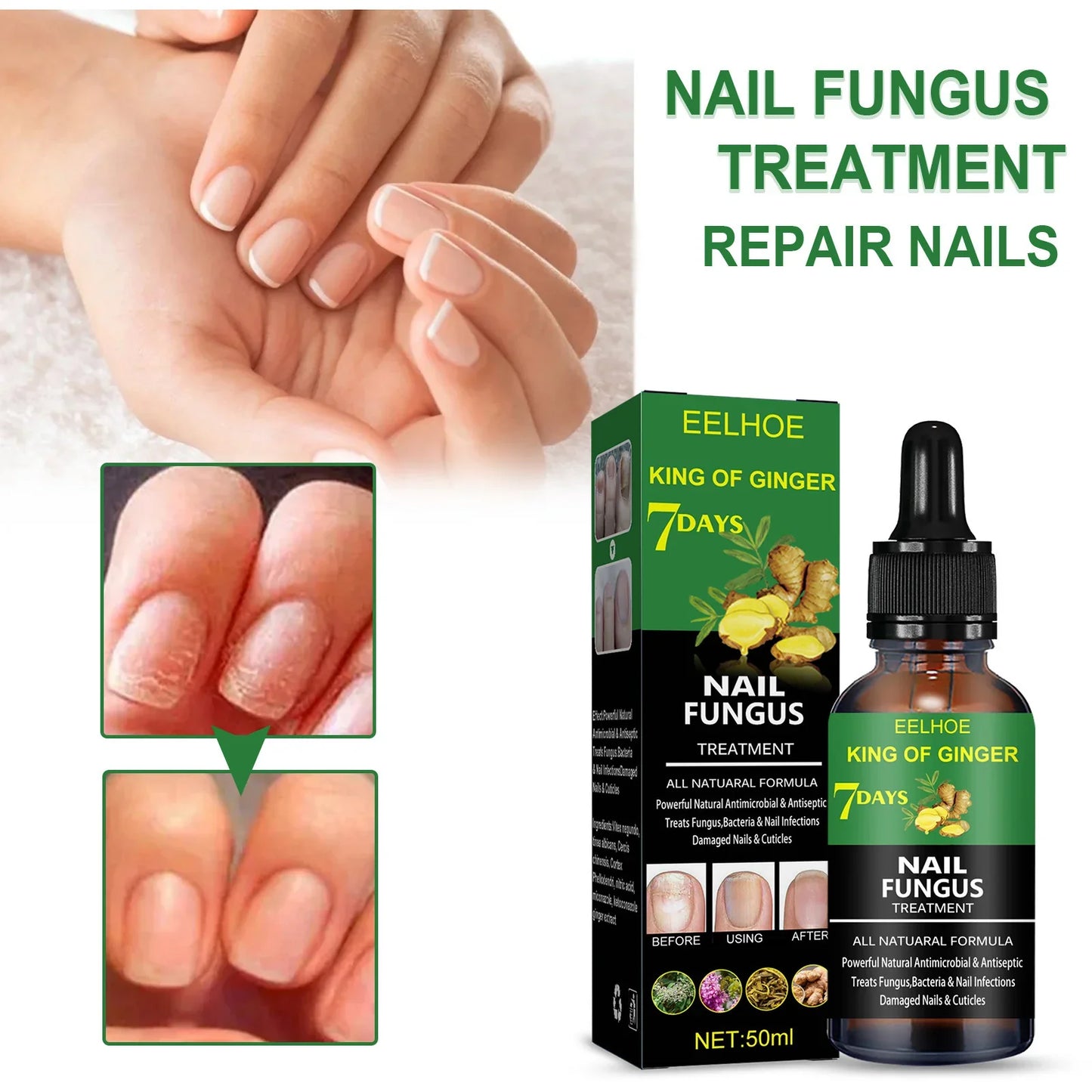 Fast Nail Care Essence | Nail Care Serum for Damaged & Discolored Nails