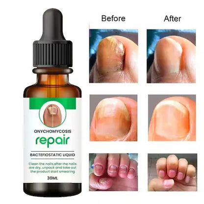 Fast Nail Care Essence | Nail Care Serum for Damaged & Discolored Nails